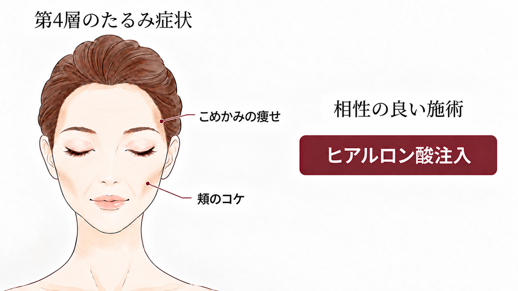 第4層(深部脂肪層)のたるみの原因と相性の良い施術
