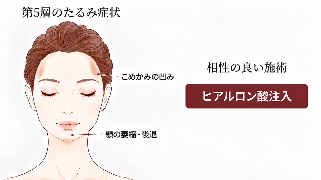 第5層(骨)のたるみの原因と相性の良い施術